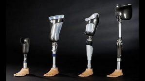 Protez bacak fiyatları ve protez bacak nedir?